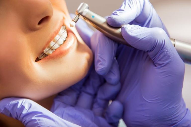 Bracify 3D Orthodontics